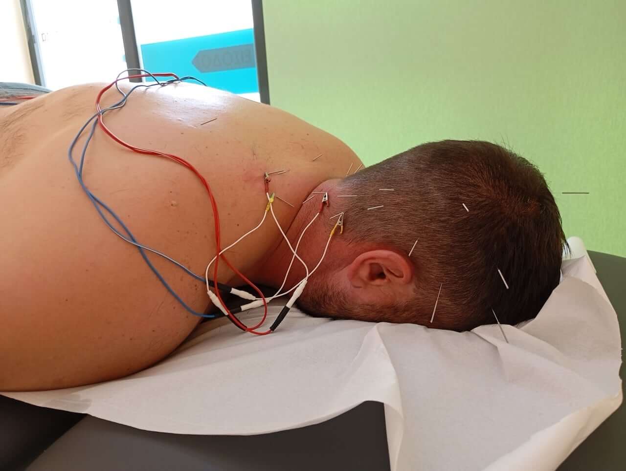 physio-mastic-velonismos-chios-sportshunter-1