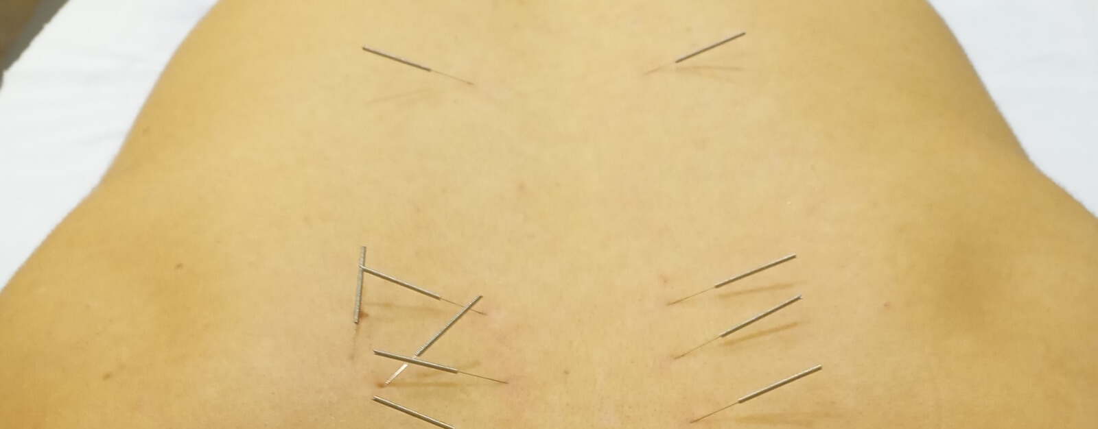 Physio Mastic